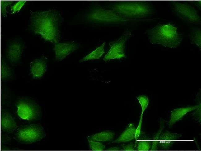 B3GNT3 Antibody in Immunocytochemistry (ICC/IF)