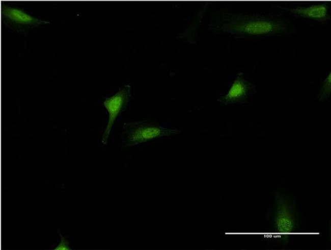 DEAF1 Antibody in Immunocytochemistry (ICC/IF)