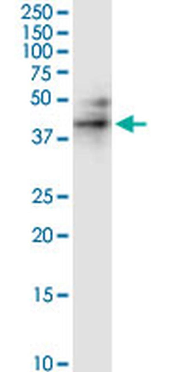 RUNDC3A Antibody in Western Blot (WB)