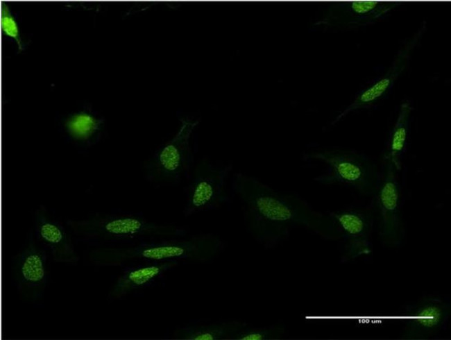 FASTK Antibody in Immunocytochemistry (ICC/IF)