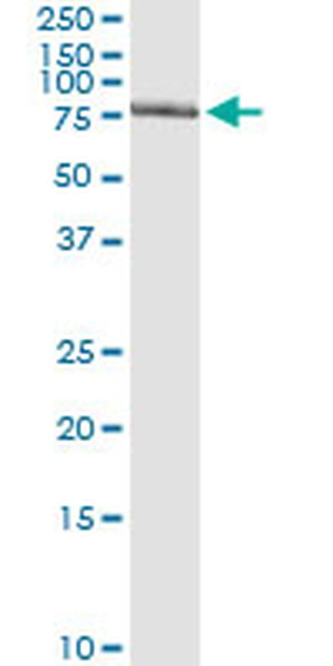 GTF2A1L Antibody in Immunoprecipitation (IP)