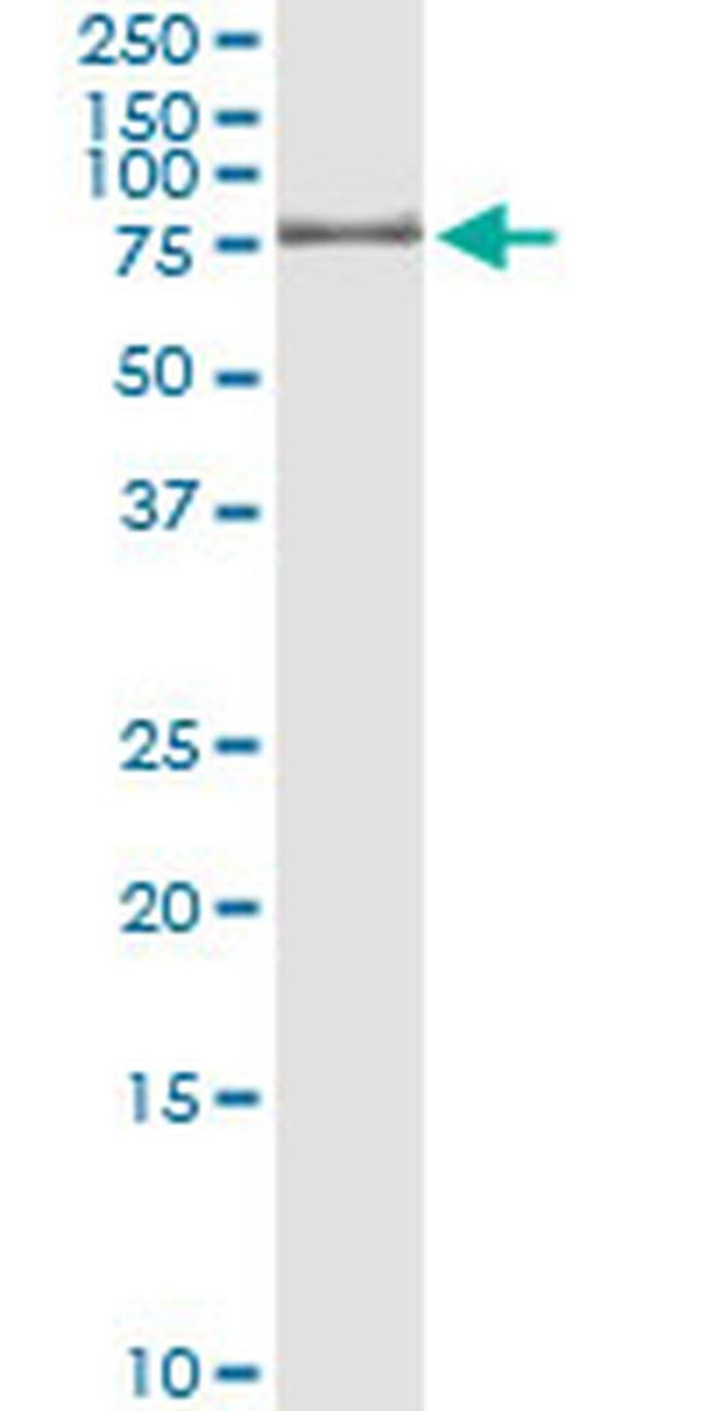 GTF2A1L Antibody in Immunoprecipitation (IP)