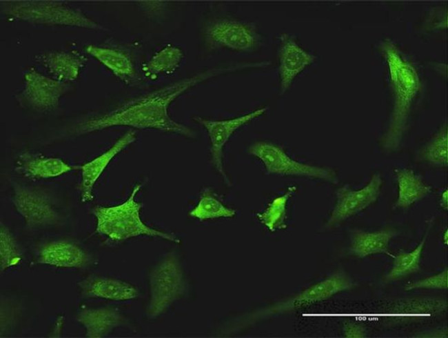 EXOSC8 Antibody in Immunocytochemistry (ICC/IF)