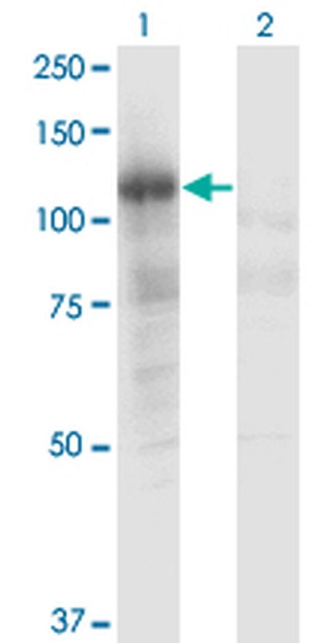 PLCL2 Antibody in Western Blot (WB)