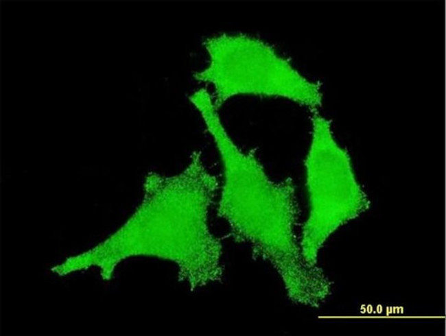 ANKRD17 Antibody in Immunocytochemistry (ICC/IF)