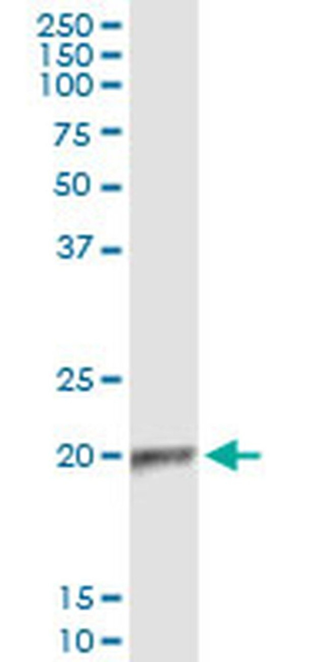 APOBEC3C Antibody in Immunoprecipitation (IP)