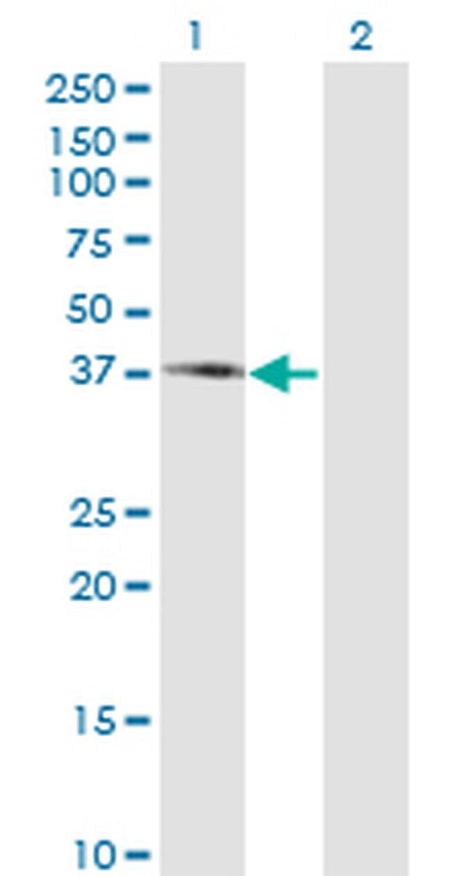 PIPOX Antibody in Western Blot (WB)