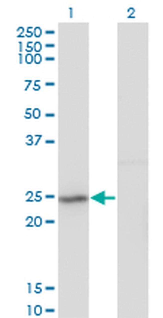 GINS2 Antibody in Western Blot (WB)