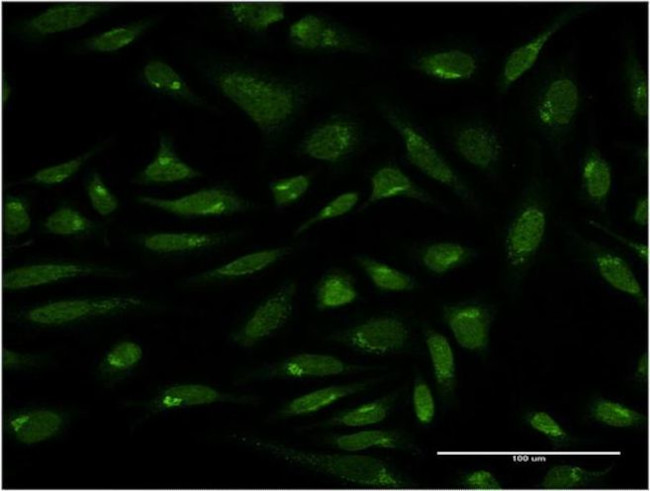 PIH1D1 Antibody in Immunocytochemistry (ICC/IF)