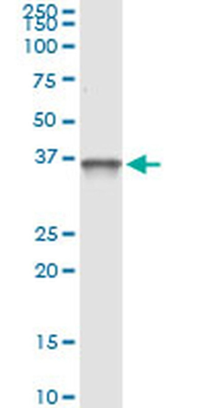 PIH1D1 Antibody in Immunoprecipitation (IP)