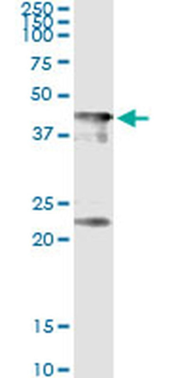 CENPJ Antibody in Immunoprecipitation (IP)