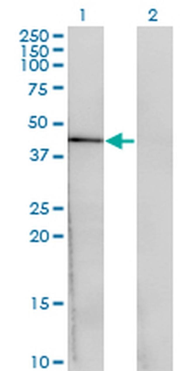 CENPJ Antibody in Western Blot (WB)