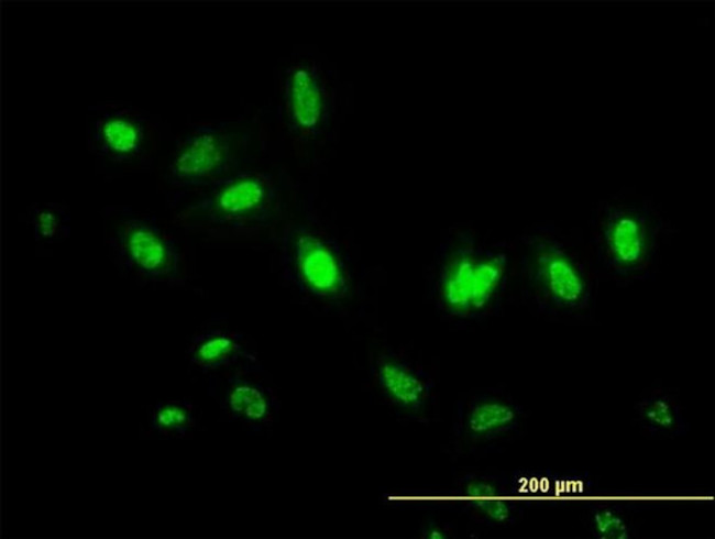 ITFG2 Antibody in Immunocytochemistry (ICC/IF)