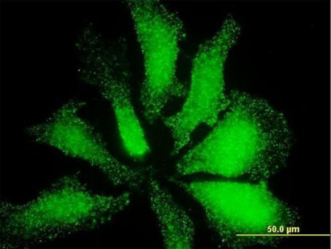 LMO3 Antibody in Immunocytochemistry (ICC/IF)