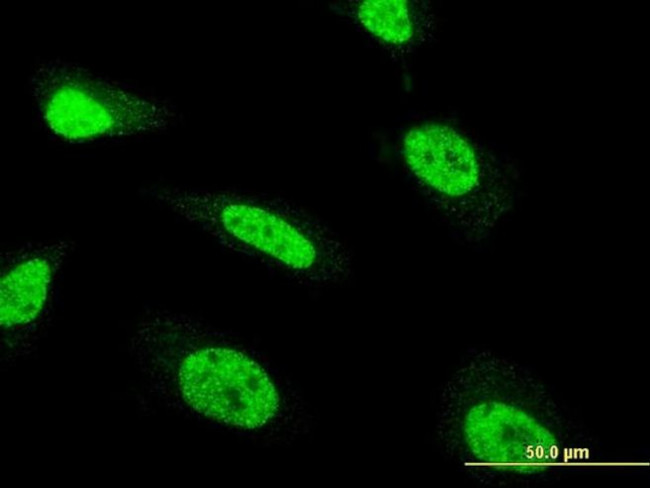 ZNF71 Antibody in Immunocytochemistry (ICC/IF)