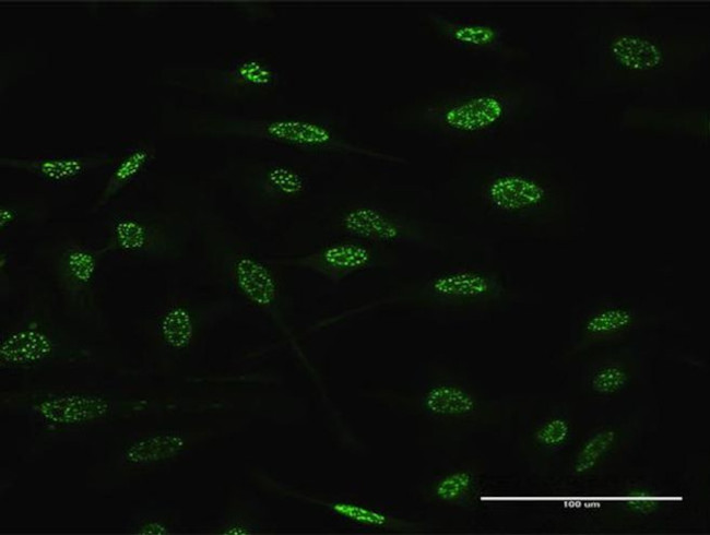 TGIF2 Antibody in Immunocytochemistry (ICC/IF)