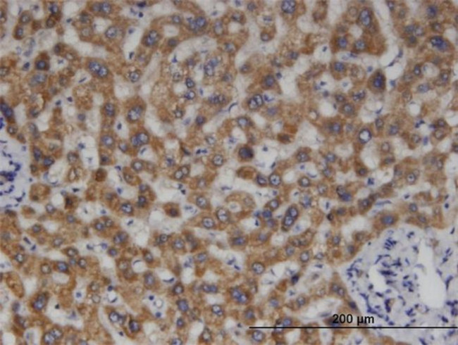 MCCC2 Antibody in Immunohistochemistry (PFA fixed) (IHC (PFA))