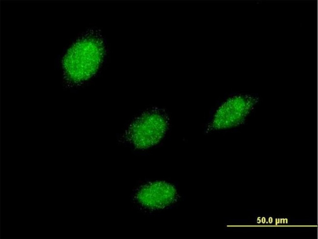 LHX5 Antibody in Immunocytochemistry (ICC/IF)