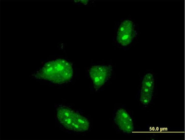 ZNF611 Antibody in Immunocytochemistry (ICC/IF)