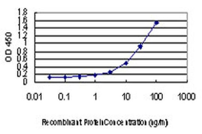 L3MBTL2 Antibody in ELISA (ELISA)