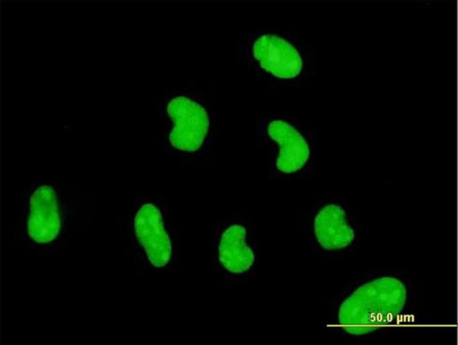 ZNF394 Antibody in Immunocytochemistry (ICC/IF)