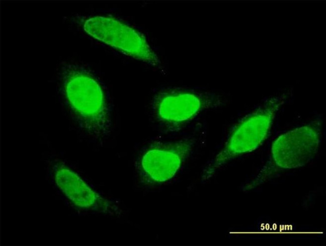 SNX29 Antibody in Immunocytochemistry (ICC/IF)