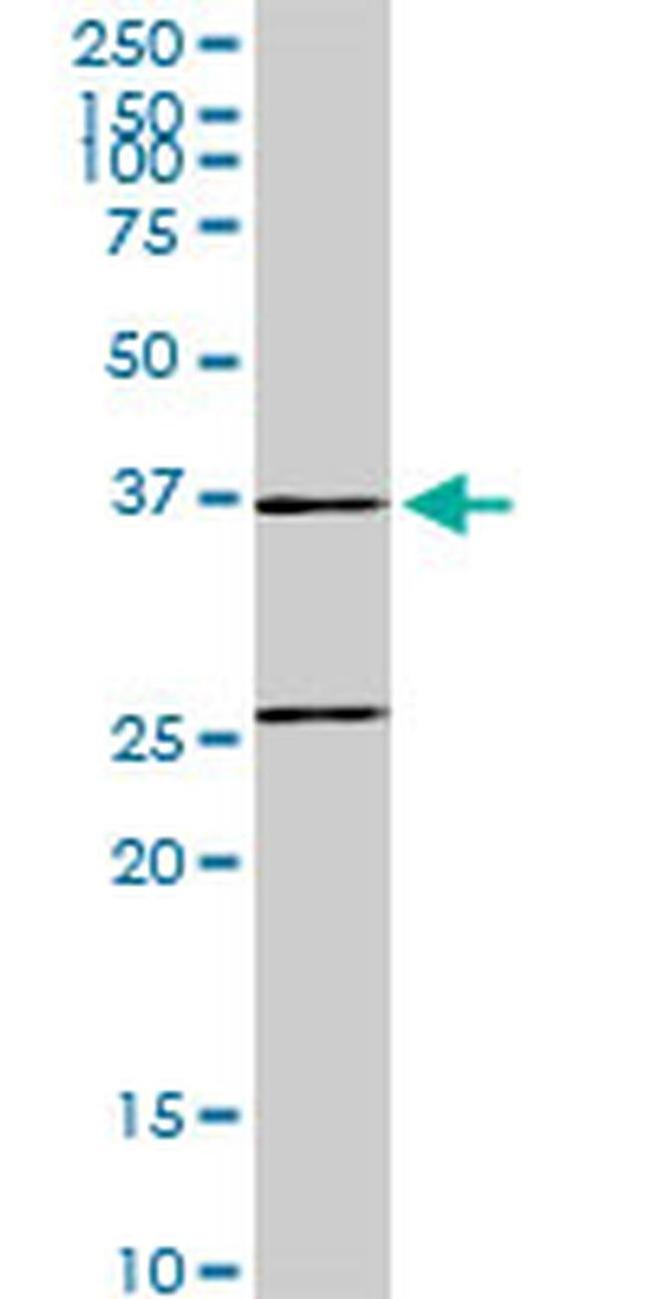 SNX29 Antibody in Western Blot (WB)