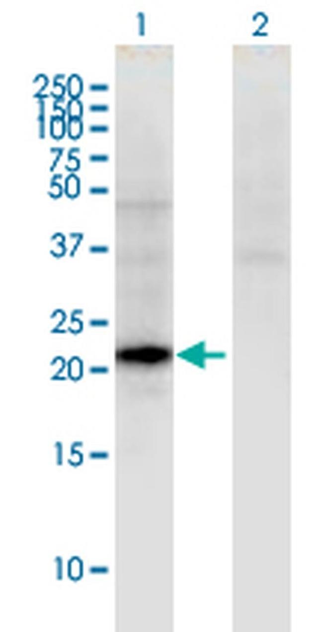 hCG beta-5 Antibody in Western Blot (WB)