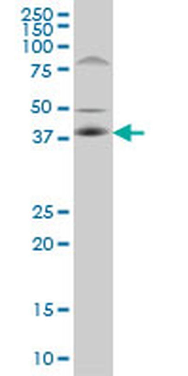 C10orf4 Antibody in Western Blot (WB)