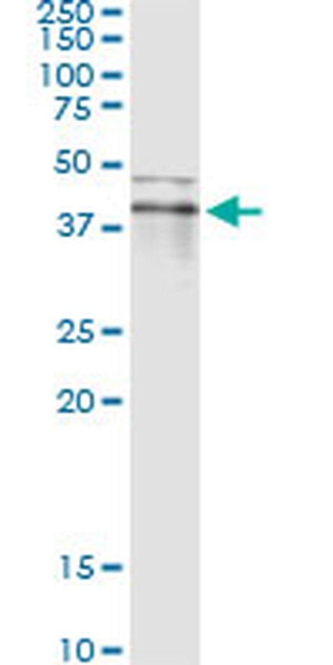 RNF113B Antibody in Immunoprecipitation (IP)