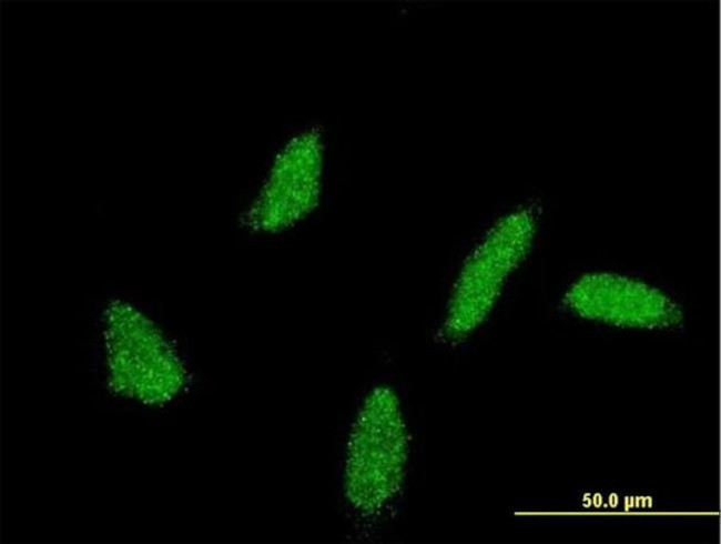 UBE2U Antibody in Immunocytochemistry (ICC/IF)