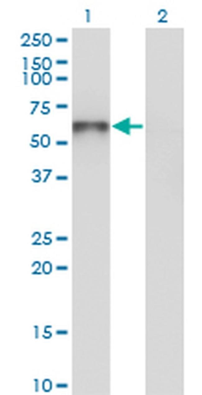 UNC5CL Antibody in Western Blot (WB)