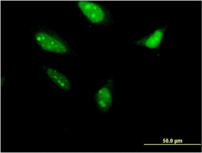 RNF212 Antibody in Immunocytochemistry (ICC/IF)