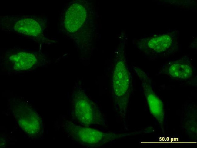 ZNF181 Antibody in Immunocytochemistry (ICC/IF)