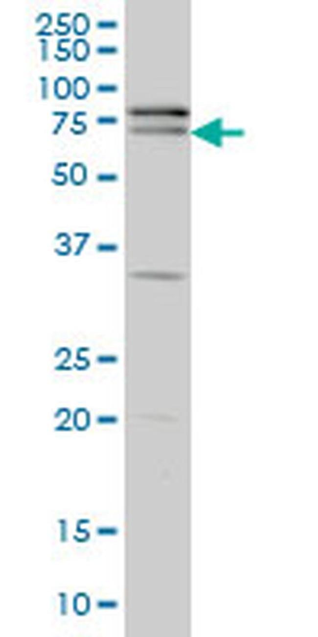 ZNF181 Antibody in Western Blot (WB)