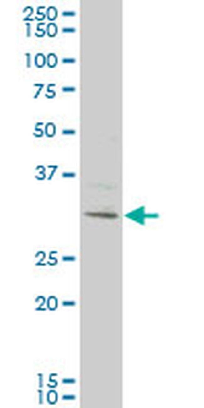 KCTD4 Antibody in Western Blot (WB)