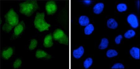 Cas9 Antibody in Immunocytochemistry (ICC/IF)