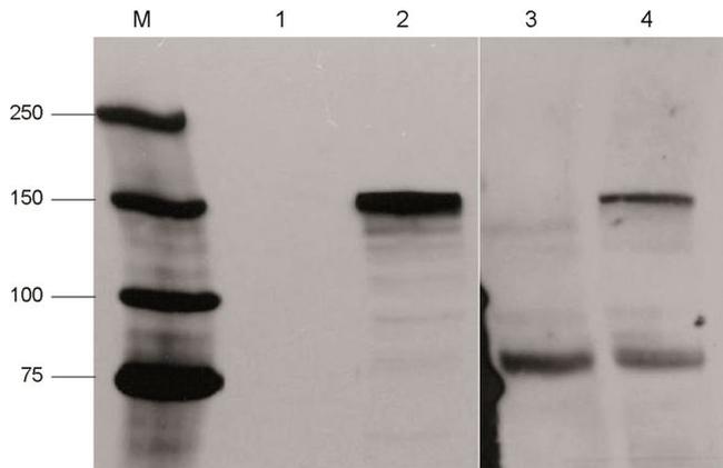 Cas9 Antibody in Western Blot (WB)