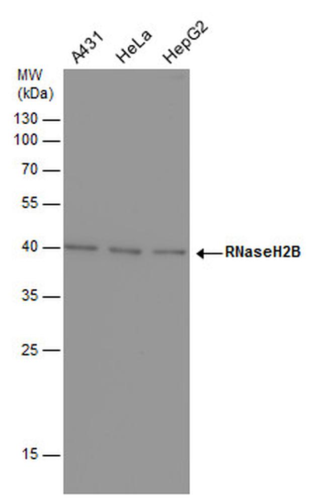 RNaseH2B Antibody in Western Blot (WB)