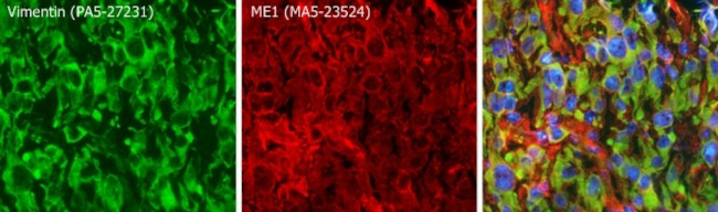 ME1 Antibody in Immunohistochemistry (Frozen) (IHC (F))