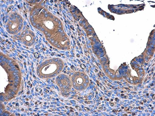 ME1 Antibody in Immunohistochemistry (Paraffin) (IHC (P))