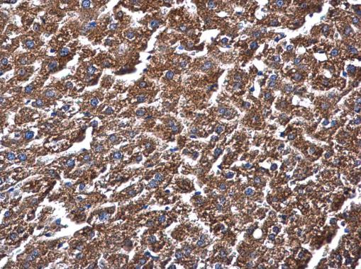 ME1 Antibody in Immunohistochemistry (Paraffin) (IHC (P))