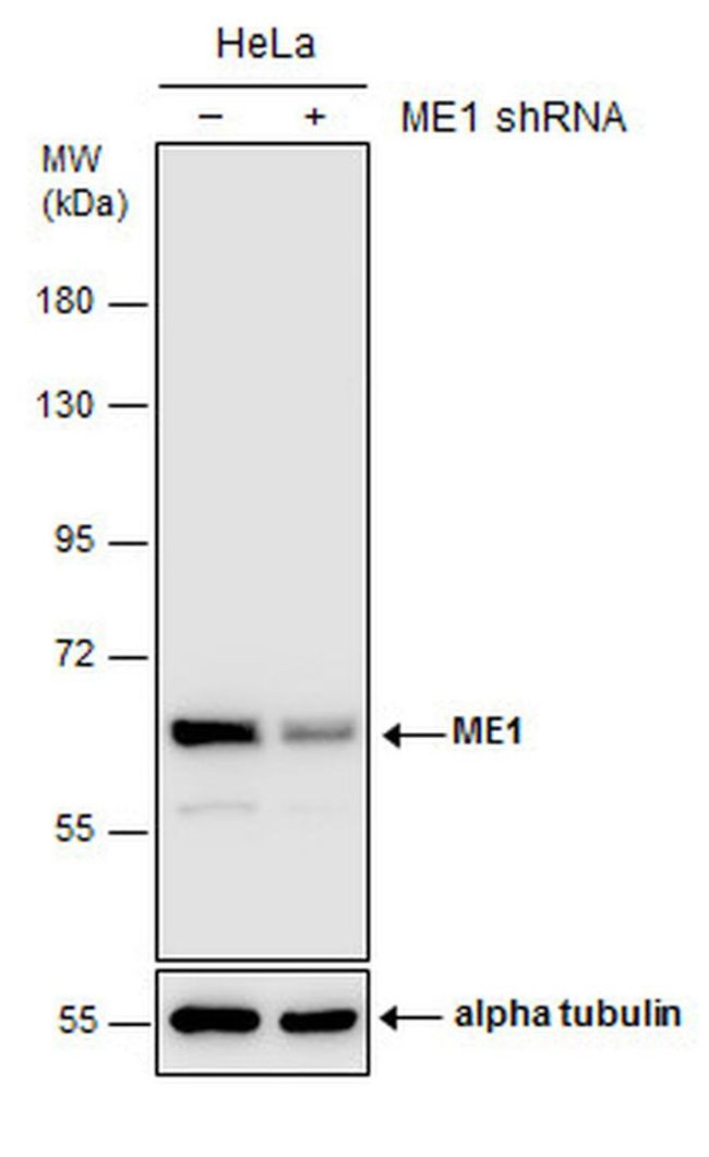 ME1 Antibody