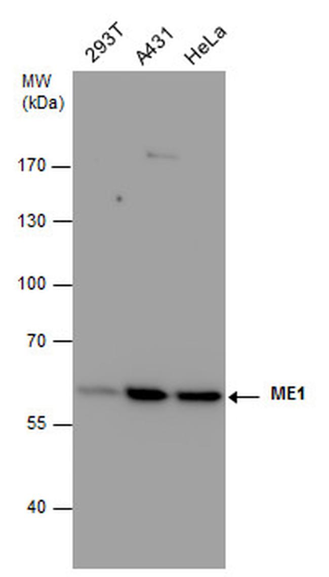 ME1 Antibody in Western Blot (WB)