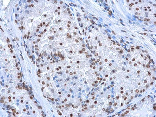 5-hydroxymethylcytosine Antibody in Immunohistochemistry (Paraffin) (IHC (P))