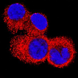 IL4R Antibody in Immunocytochemistry (ICC/IF)