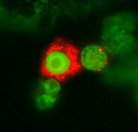 CD123 Antibody in Immunocytochemistry (ICC/IF)