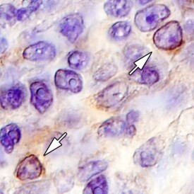 CD123 Antibody in Immunohistochemistry (Paraffin) (IHC (P))