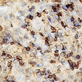 Eotaxin Antibody in Immunohistochemistry (Frozen) (IHC (F))