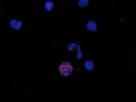 MIP-3 beta Antibody in Immunocytochemistry (ICC/IF)